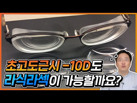 초고도근시, 라식라섹 가능할까? #투데이라섹 #2day라섹 #오정우원장 #이오스안과