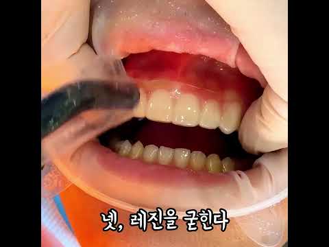 라미네이트 얼마나 예뻐지는지 미리 아는 방법!