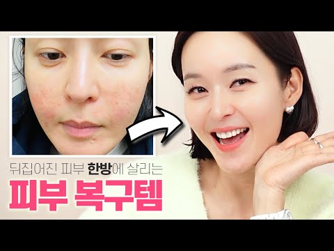 [EP101] 한순간 망가진 피부 확 되돌리는 법 😡민감성 피부 모두 모이세요│피부복구템|랑콤|라로슈포제