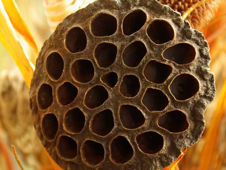 Trypophobia: Triggers, Causes, Treatment, And More