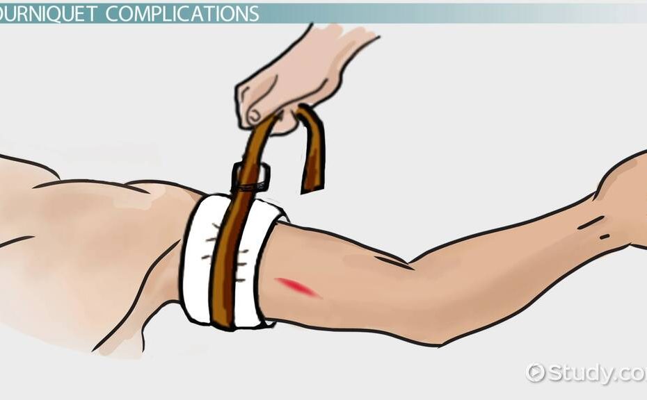 Dangers & Complications Of Tourniquets - Video & Lesson Transcript |  Study.Com