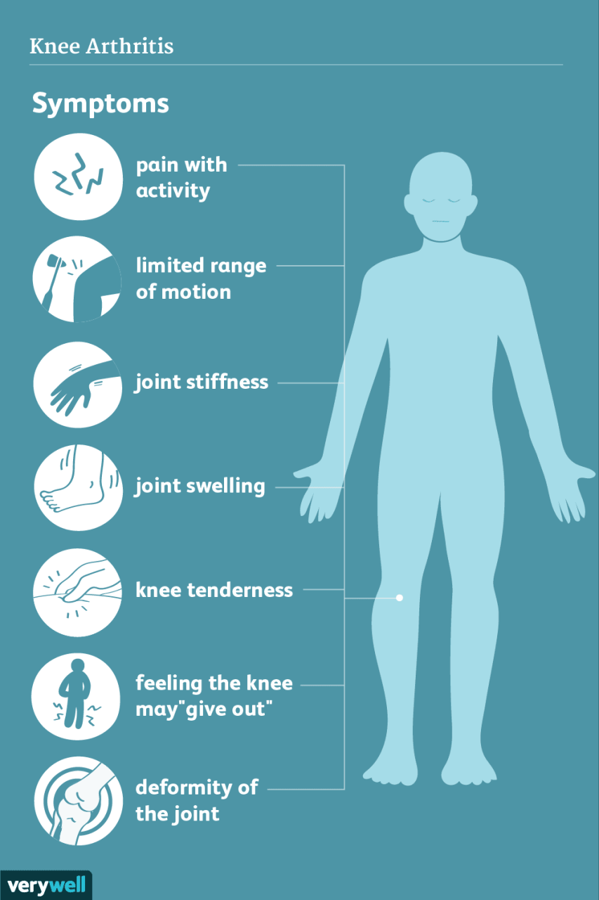 Knee Arthritis: Symptoms, Causes, Diagnosis, Treatment