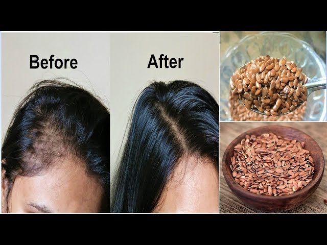 Your Hair Will Grow Like Crazy! Just Eat 1 Tablespoon Daily For Hair Growth,  Flaxseeds For Long Hair - Youtube