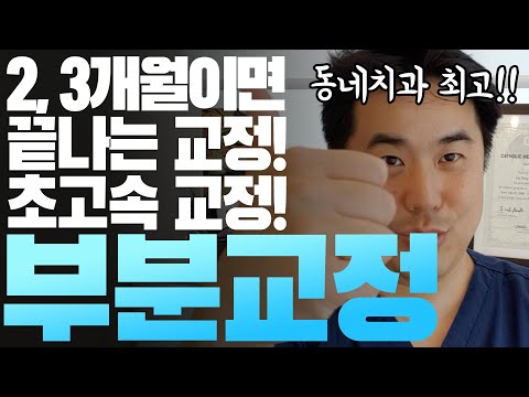👍동네치과 궈궈!!! 👍2-3달에 끝나는 빠른 치아교정이 있다!!! 부분교정!!!!