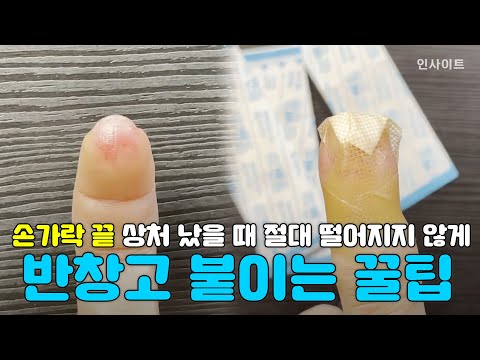 '손가락 끝' 상처 났을 때 절대 떨어지지 않게 반창고 붙이는 꿀팁